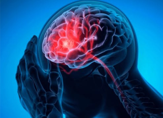 International Conference on Brain Stroke Management & Neurovascular Medicine